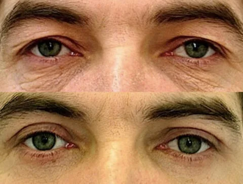 Before / After — 4