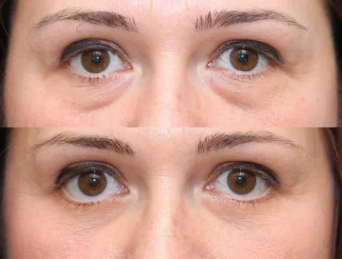 Before / After — 7