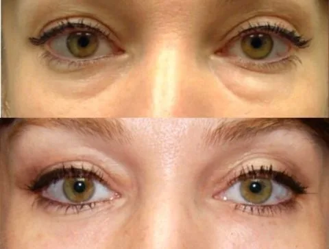 Before / After — 8